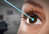 Can Insurance Cover Lasik