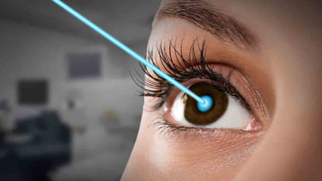 Can Insurance Cover Lasik