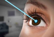 Can Insurance Cover Lasik