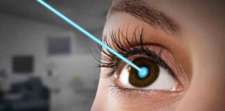 Can Insurance Cover Lasik